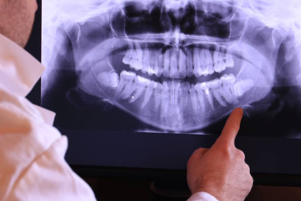 Best Emergency Dental Extractions in Larch Y, WA